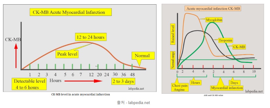 CK-MB peak time 그림