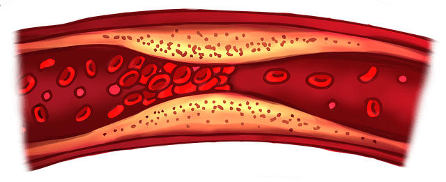 혈관 속 노폐물이 쌓여 있는 사진