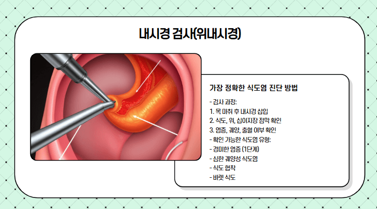 위내시경 사진