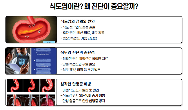 식도염이란? 내용 사진